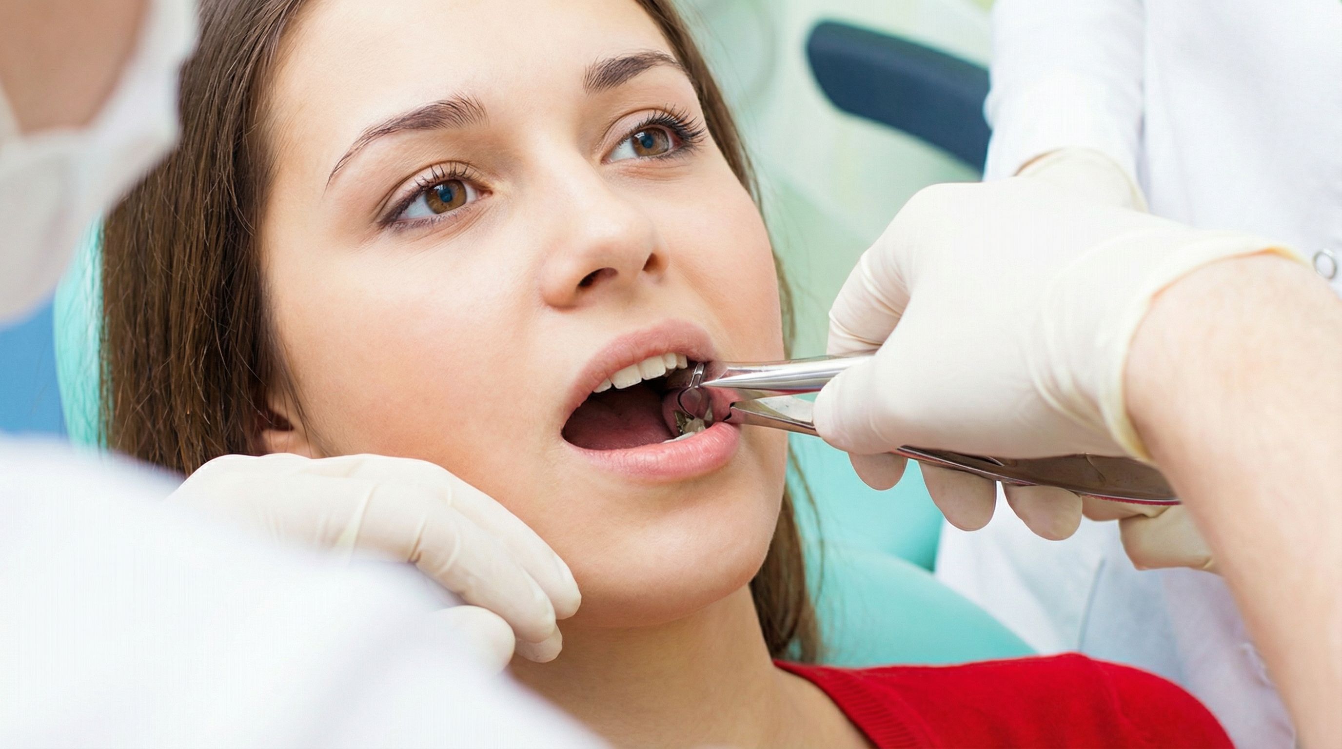 Dentist removing a tooth with extraction forceps